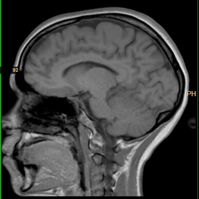 barbara - what happened to the games